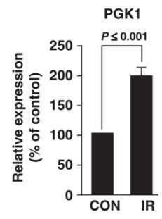Expressions of PGK1.jpg